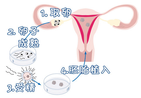 私人高龄借卵联系电话